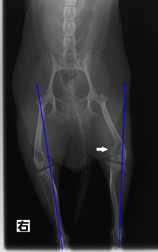 膝蓋骨脱臼 手術 パテラ 1 ペイント