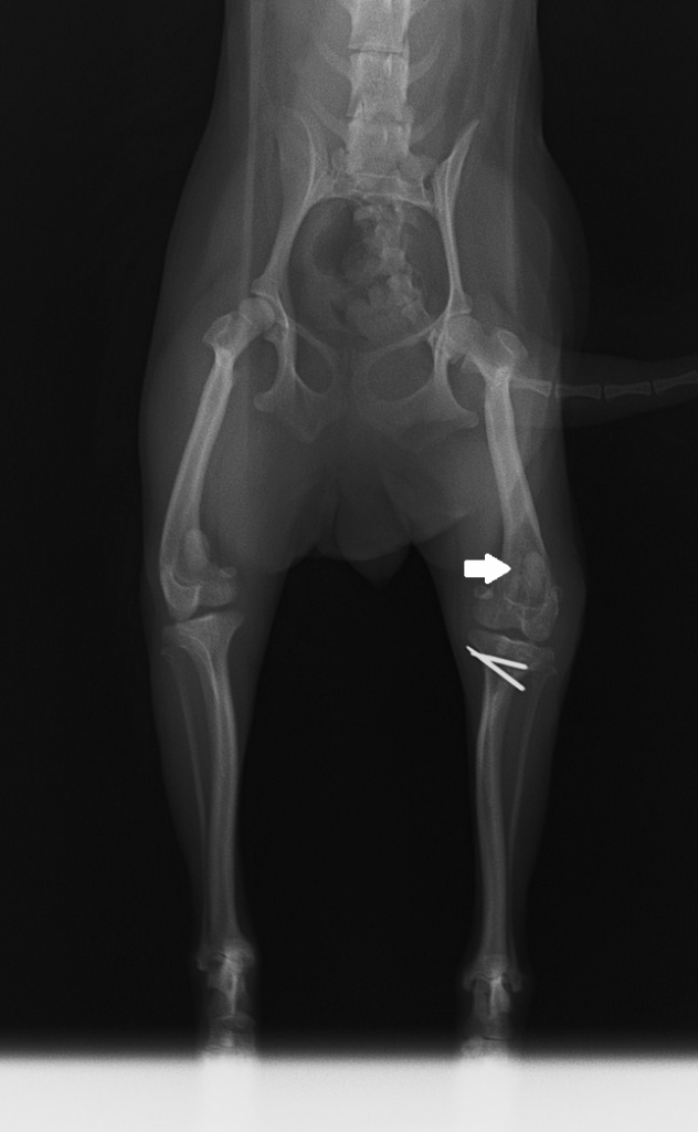 膝蓋骨脱臼 手術 パテラ 5 ペイント